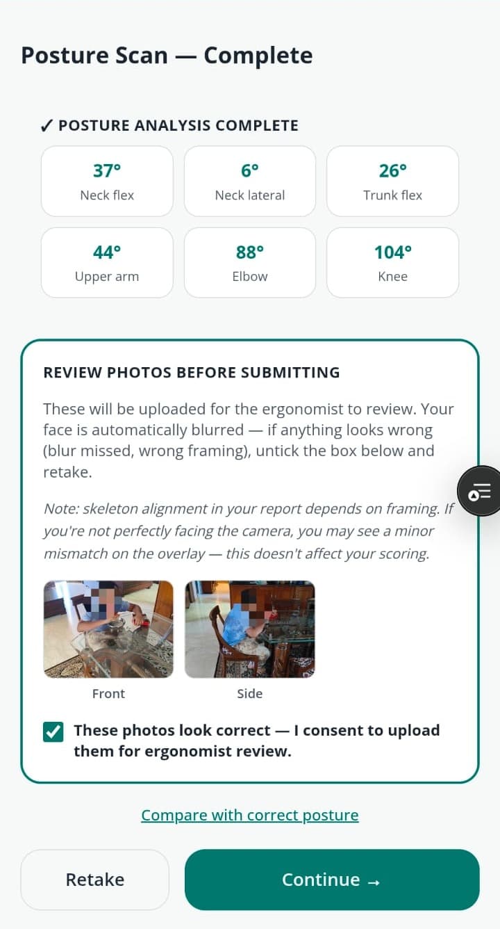 Ergocure worker assessment — Camera · posture scan